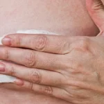 Titanium Breast Marker