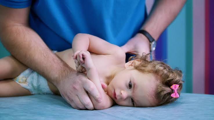 Cerebral Palsy
