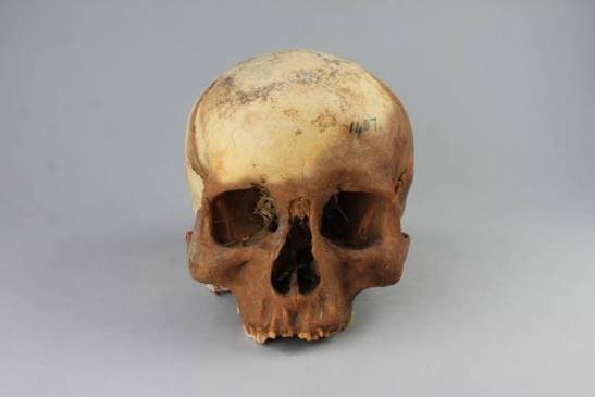 Is It Legal to Own a Human Skull?